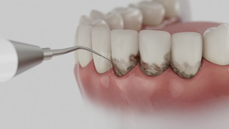 Trusted Tooth Extraction service in Xenia, OH - Dentist Open Now